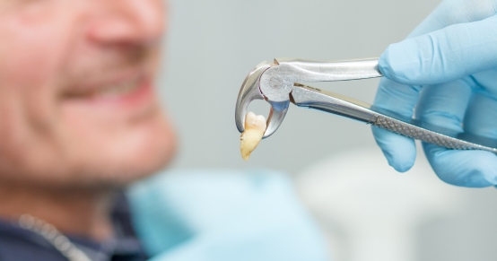 wisdom teeth extraction and pain management
