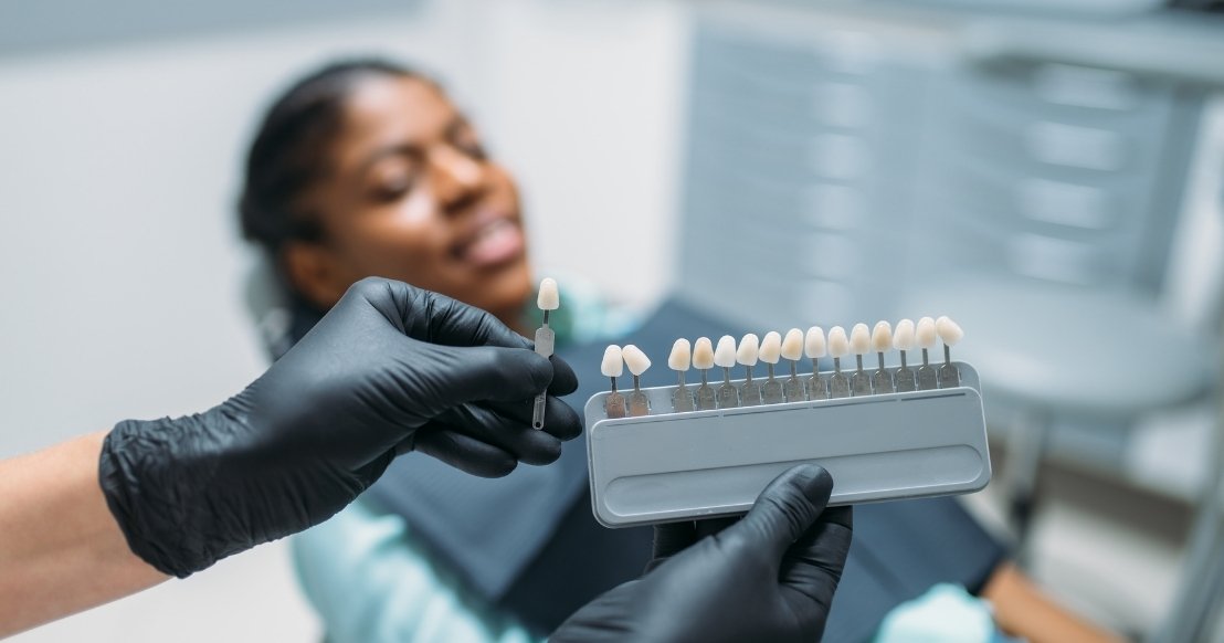 can you drink coffee with veneers