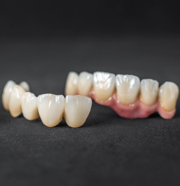 Improve Your Smile with Crown Lengthening