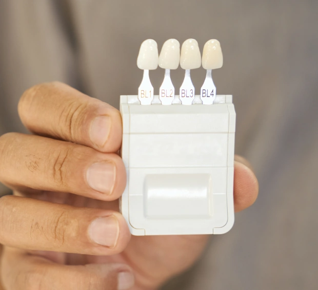 Conservative Solutions for a Natural Smile