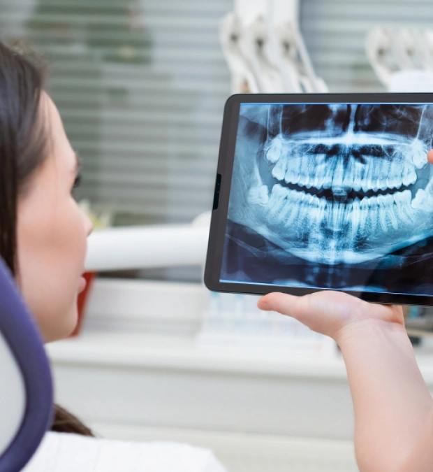 Custom Mouthguards for Smile Protection