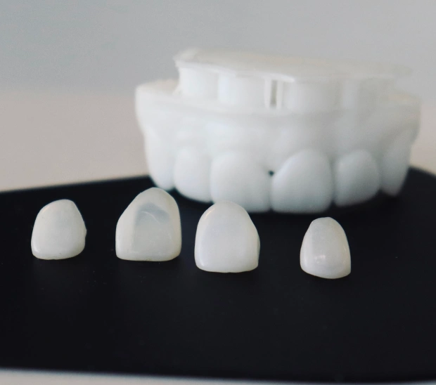 Conservative Care for a Polished Smile