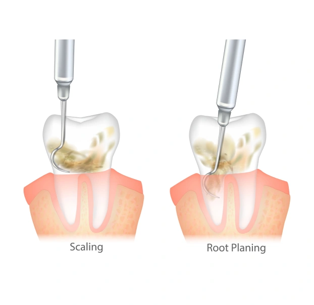 Healthy Gums Start Here