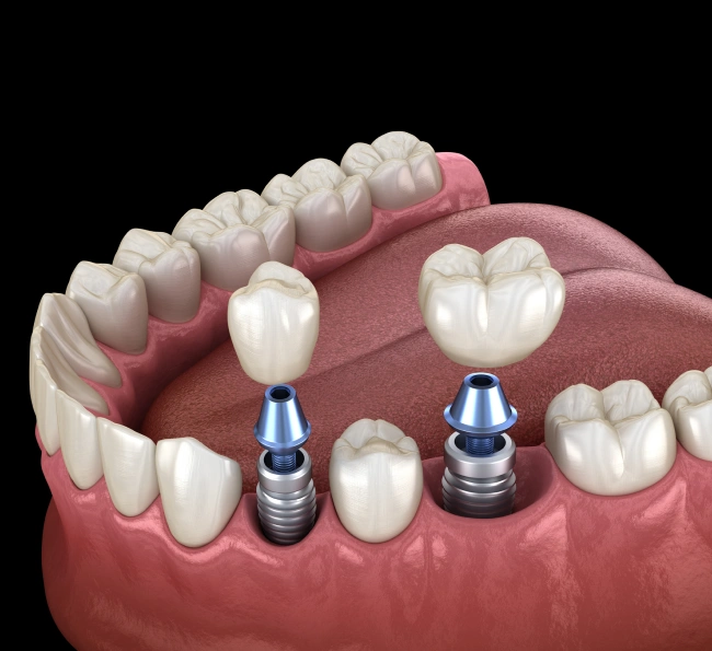 Welcome to Dental Artistry in Irving, TX